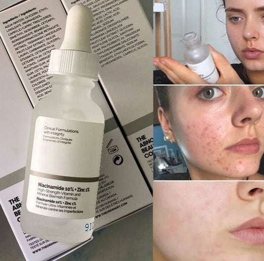 The Ordinary Niacinamide 10% + Zinc 1% Serum – Oil Control, Pore Minimizer & Brightening
