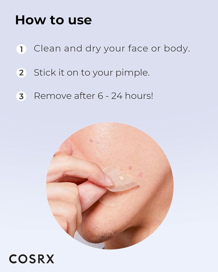 COSRX Acne Pimple Master Patch – Overnight Spot Treatment